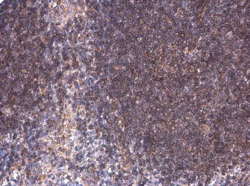 BTK (phospho Tyr223) antibody
