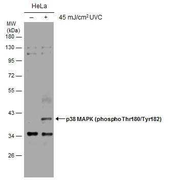 Untreated (–) and treated (+) HeLa whole cell extracts (30 μg) were separated by 10% SDS-PAGE, and the membrane was blotted with p38 MAPK (phospho Thr180/Tyr182) antibody (GTX130383) diluted at 1:500.