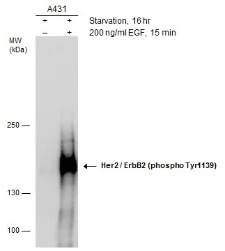 Her2 / ErbB2 (phospho Tyr1139) antibody