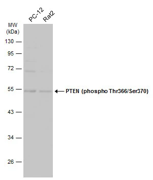 Various whole cell extracts (30 μg) were separated by 10% SDS-PAGE, and the membrane was blotted with PTEN (phospho Thr366/Ser370) antibody (GTX130418) diluted at 1:500. The HRP-conjugated anti-rabbit IgG antibody (GTX213110-01) was used to detect the primary antibody.