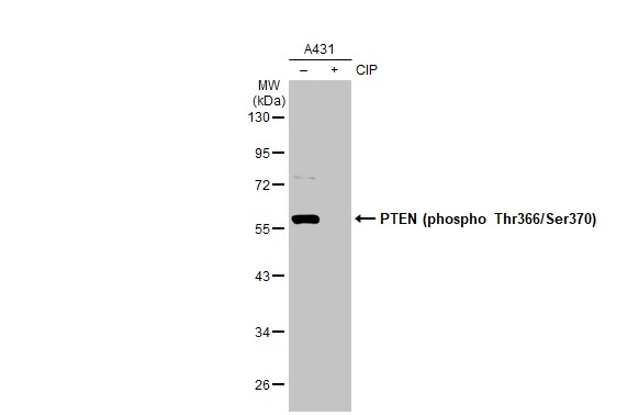 Untreated (–) and treated (+) A431 whole cell extracts (30 μg) were separated by 10% SDS-PAGE, and the membrane was blotted with PTEN (phospho Thr366/Ser370) antibody (GTX130418) diluted at 1:500. The HRP-conjugated anti-rabbit IgG antibody (GTX213110-01) was used to detect the primary antibody.