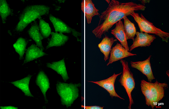 PTEN (phospho Thr366/Ser370) antibody detects PTEN (phospho Thr366/Ser370) protein at cytoplasm and nucleus by immunofluorescent analysis. Sample: HeLa cells were fixed in 4% paraformaldehyde at RT for 15 min. Green: PTEN (phospho Thr366/Ser370) stained by PTEN (phospho Thr366/Ser370) antibody (GTX130418) diluted at 1:500. Red: alpha Tubulin, a cytoskeleton marker, stained by alpha Tubulin antibody [GT114] (GTX628802) diluted at 1:1000. Blue: Fluoroshield with DAPI (GTX30920). Scale bar= 10μm.