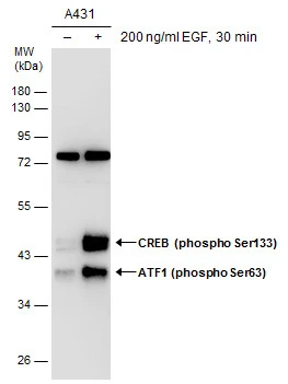 Untreated (–) and treated (+) A431 whole cell extracts (50 μg) were separated by 10% SDS-PAGE, and the membrane was blotted with ATF1 (phospho Ser63) antibody (GTX130420) diluted at 1:5000. Untreated (–) and treated (+) A431 whole cell extracts (50 μg) were separated by 10% SDS-PAGE, and the membrane was blotted with ATF1 (phospho Ser63) antibody (GTX130420) diluted at 1:5000.