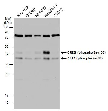 Various whole cell extracts (30 μg) were separated by 12% SDS-PAGE, and the membrane was blotted with ATF1 (phospho Ser63) antibody (GTX130420) diluted at 1:5000. The HRP-conjugated anti-rabbit IgG antibody (GTX213110-01) was used to detect the primary antibody.