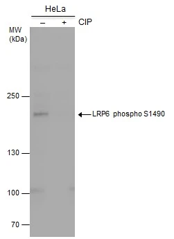 Untreated (–) and treated (+) HeLa whole cell extracts (30 μg) were separated by 5% SDS-PAGE, and the membrane was blotted with LRP6 phospho S1490 antibody (GTX130421) diluted at 1:1000. (CIP: Calf-intestinal alkaline phosphatase)