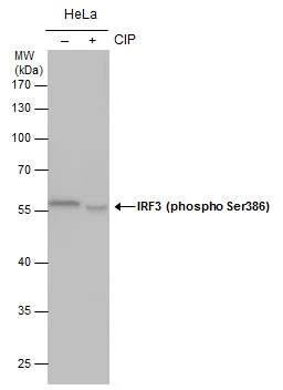 IRF3 (phospho Ser386) antibody detects IRF3 (phospho Ser386) protein by western blot analysis. Un-treated (-) and treated (+, CIP treatment for 1hr) HeLa whole cell extracts (30 μg) were separated by 10% SDS-PAGE, and the membrane was blotted with IRF3 (phospho Ser386) antibody (GTX130422) at a dilution of 1:5000.
