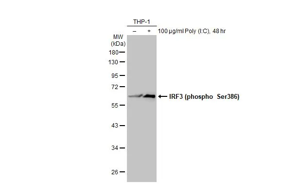 Untreated (–) and treated (+) THP-1 whole cell extracts (30 μg) were separated by 10% SDS-PAGE, and the membrane was blotted with IRF3 (phospho Ser386) antibody (GTX130422) diluted at 1:500. The HRP-conjugated anti-rabbit IgG antibody (GTX213110-01) was used to detect the primary antibody.