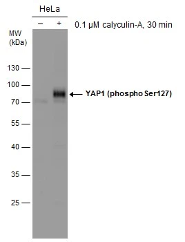 Untreated (–) and treated (+) HeLa whole cell extracts (30 μg) were separated by 10% SDS-PAGE, and the membrane was blotted with YAP1 (phospho Ser127) antibody (GTX130424) diluted at 1:5000.