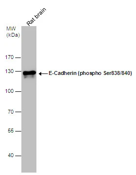 E-Cadherin (phospho Ser838/840) antibody detects E-Cadherin (phospho Ser838/840) protein by western blot analysis. Rat tissue extracts (50 μg) was separated by 7.5% SDS-PAGE, and the membrane was blotted with E-Cadherin (phospho Ser838/840) antibody (GTX130427) diluted at 1:10000. E-Cadherin (phospho Ser838/840) antibody detects E-Cadherin (phospho Ser838/840) protein by western blot analysis. Rat tissue extracts (50 μg) was separated by 7.5% SDS-PAGE, and the membrane was blotted with E-Cadherin (phospho Ser838/840) antibody (GTX130427) diluted at 1:10000.
