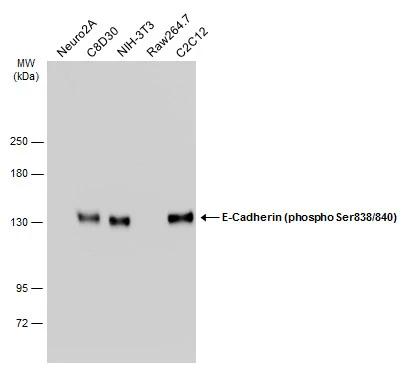 Various whole cell extracts (30 μg) were separated by 5% SDS-PAGE, and the membrane was blotted with E-Cadherin (phospho Ser838/840) antibody (GTX130427) diluted at 1:1000. The HRP-conjugated anti-rabbit IgG antibody (GTX213110-01) was used to detect the primary antibody. Various whole cell extracts (30 μg) were separated by 5% SDS-PAGE, and the membrane was blotted with E-Cadherin (phospho Ser838/840) antibody (GTX130427) diluted at 1:1000. The HRP-conjugated anti-rabbit IgG antibody (GTX213110-01) was used to detect the primary antibody.