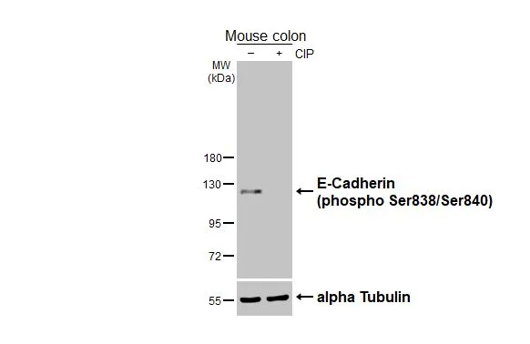 Human Cytogenetics 第3版 Anti-E-Cadherin (phospho Ser838/840) antibody (GTX130427