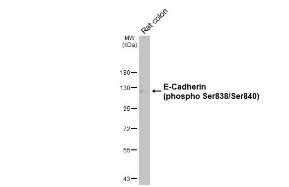 Rat tissue extract (50 μg) was separated by 7.5% SDS-PAGE, and the membrane was blotted with E-Cadherin (phospho Ser838/840) antibody (GTX130427) diluted at 1:10000. The HRP-conjugated anti-rabbit IgG antibody (GTX213110-01) was used to detect the primary antibody. Rat tissue extract (50 μg) was separated by 7.5% SDS-PAGE, and the membrane was blotted with E-Cadherin (phospho Ser838/840) antibody (GTX130427) diluted at 1:10000. The HRP-conjugated anti-rabbit IgG antibody (GTX213110-01) was used to detect the primary antibody.