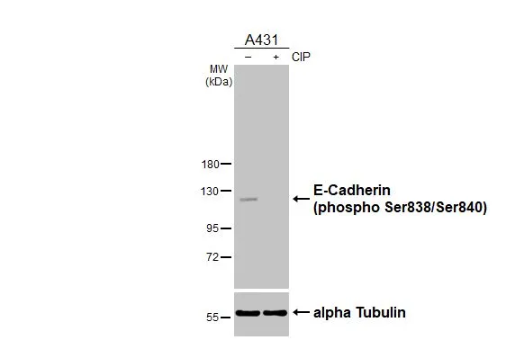 Untreated (–) and treated (+) A431 whole cell extracts (30 μg) were separated by 7.5% SDS-PAGE, and the membrane was blotted with E-Cadherin (phospho Ser838/840) antibody (GTX130427) diluted at 1:1000. The HRP-conjugated anti-rabbit IgG antibody (GTX213110-01) was used to detect the primary antibody. Untreated (–) and treated (+) A431 whole cell extracts (30 μg) were separated by 7.5% SDS-PAGE, and the membrane was blotted with E-Cadherin (phospho Ser838/840) antibody (GTX130427) diluted at 1:1000. The HRP-conjugated anti-rabbit IgG antibody (GTX213110-01) was used to detect the primary antibody.