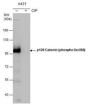 p120 Catenin (phospho Ser268) antibody detects p120 Catenin (phospho Ser268) protein by western blot analysis. Un-treated (-) and treated (+, CIP treatment) A431 whole cell extracts (30 μg) were separated by 7.5% SDS-PAGE, and the membrane was blotted with p120 Catenin (phospho Ser268) antibody (GTX130428) diluted at 1:1000. (CIP: Calf-intestinal alkaline phosphatase)
