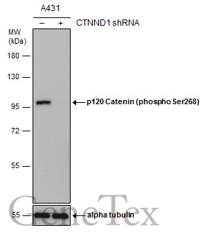 Non-transfected (–) and transfected (+) A431 whole cell extracts (30 μg) were separated by 7.5% SDS-PAGE, and the membrane was blotted with p120 Catenin (phospho Ser268) antibody (GTX130428) diluted at 1:3000.