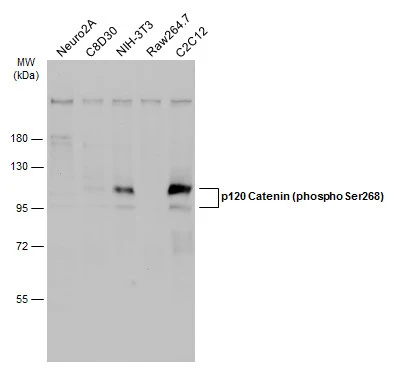 Various whole cell extracts (30 μg) were separated by 7.5% SDS-PAGE, and the membrane was blotted with p120 Catenin (phospho Ser268) antibody (GTX130428) diluted at 1:500. The HRP-conjugated anti-rabbit IgG antibody (GTX213110-01) was used to detect the primary antibody.