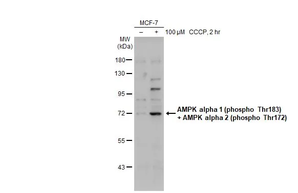 ラスティapmk Anti-AMPK alpha 1 (phospho Thr183) + AMPK alpha 2 (phospho Thr172