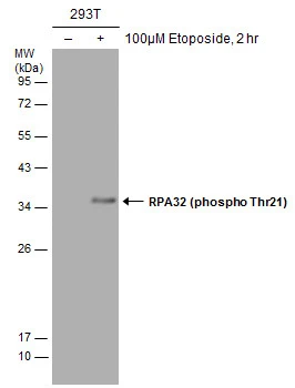 Untreated (–) and treated (+) 293T whole cell extracts (30 μg) were separated by 12% SDS-PAGE, and the membrane was blotted with RPA32 (phospho Thr21) antibody (GTX130432) diluted at 1:1000.