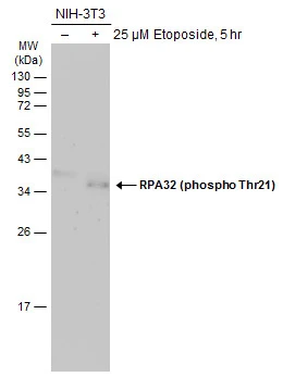 Anti-RPA32 (phospho Thr21) antibody (GTX130432) | GeneTex