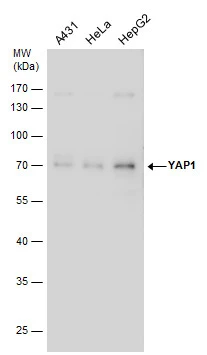 Non-transfected (�) and transfected (+) 293T whole cell extracts (30 ug) were separated by 10% SDS-PAGE,and the membrane was blotted with YAP1 antibody (GTX130444) diluted at 1:1000.