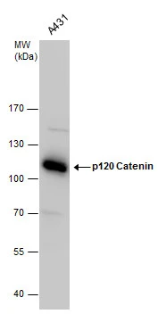 p120 Catenin antibody detects p120 Catenin protein by western blot analysis. Serum-starved A431 whole cell extracts (30 μg) were separated by 7.5% SDS-PAGE, and the membrane was blotted with p120 Catenin antibody (GTX130448) at a dilution of 1:1000.