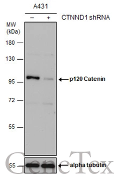 Non-transfected (–) and transfected (+) A431 whole cell extracts (30 μg) were separated by 7.5% SDS-PAGE, and the membrane was blotted with p120 Catenin antibody (GTX130448) diluted at 1:5000.