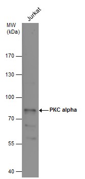 Whole cell extract (30 ug) was separated by 7.5% SDS-PAGE,and the membrane was blotted with PKC alpha antibody (GTX130453) diluted at 1:1000.
