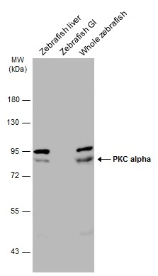 Anti-PKC alpha antibody (GTX130453) | GeneTex