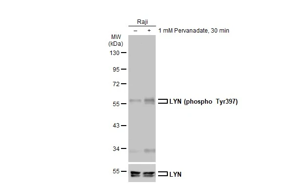 Untreated (–) and treated (+) Raji whole cell extracts (30 μg) were separated by 10% SDS-PAGE, and the membrane was blotted with LYN (phospho Tyr397) antibody (GTX130454) diluted at 1:500. The HRP-conjugated anti-rabbit IgG antibody (GTX213110-01) was used to detect the primary antibody. Untreated (–) and treated (+) Raji whole cell extracts (30 μg) were separated by 10% SDS-PAGE, and the membrane was blotted with LYN (phospho Tyr397) antibody (GTX130454) diluted at 1:500. The HRP-conjugated anti-rabbit IgG antibody (GTX213110-01) was used to detect the primary antibody.
