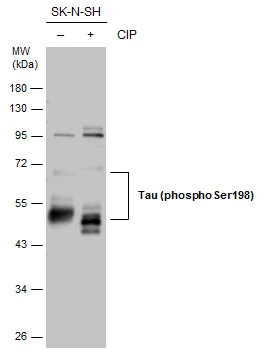 Untreated (–) and treated (+) SK-N-SH whole cell extracts (30 μg) were separated by 10% SDS-PAGE, and the membrane was blotted with Tau (phospho Ser198) antibody (GTX130456) diluted at 1:500.