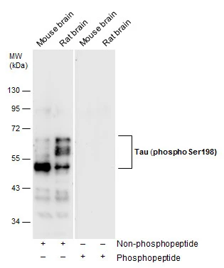 Various tissue extracts (50 μg) were separated by 10% SDS-PAGE, and the membrane was blotted with Tau (phospho Ser198) antibody (GTX130456) diluted at 1:5000.