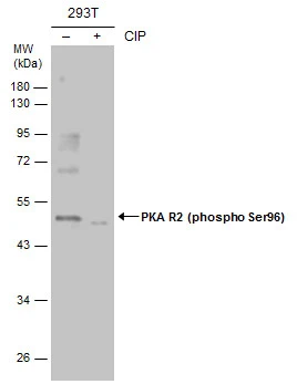 PKA R2 (phospho Ser99) antibody