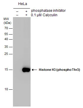 Histone H3 (phospho Thr3) antibody detects Histone H3 (phospho Thr3) protein by western blot analysis. Un-treated (-) and treated (+, 0.1uM Calyculin for 30 minutes + phosphatase inhibitor) HeLa whole cell extracts (2 μg) were separated by 15% SDS-PAGE, and the membrane was blotted with Histone H3 (phospho Thr3) antibody (GTX130458) at a dilution of 1:10000.