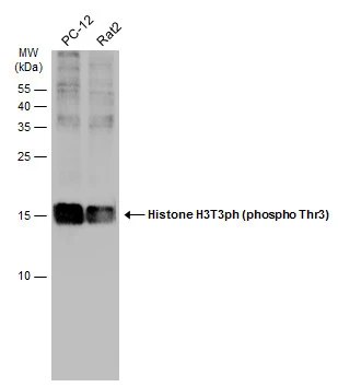 Various whole cell extracts (30 μg) were separated by 15% SDS-PAGE, and the membrane was blotted with Histone H3T3ph (phospho Thr3) antibody (GTX130458) diluted at 1:500. The HRP-conjugated anti-rabbit IgG antibody (GTX213110-01) was used to detect the primary antibody.