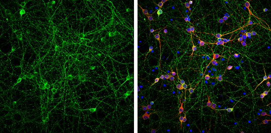 Anti-Tau antibody (GTX130462) | GeneTex