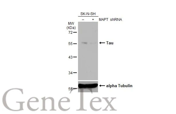 Anti-Tau antibody (GTX130462) | GeneTex