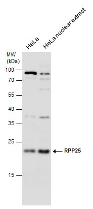 RPP25 antibody detects RPP25 protein by western blot analysis. HeLa whole cell extracts and nuclear extracts (30 μg) were separated by 12% SDS-PAGE, and the membrane was blotted with RPP25 antibody (GTX130473) diluted at 1:1000.