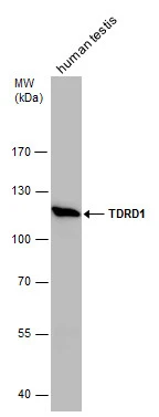 TDRD1 antibody detects TDRD1 protein by western blot analysis. Human tissue extracts (30 μg) was separated by 7.5 % SDS-PAGE, and the membrane was blotted with TDRD1 antibody (GTX130485) at a dilution of 1:1000.