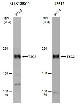 Whole cell extract (30 μg) was separated by 5% SDS-PAGE, and the membranes were blotted with TSC2 antibody (GTX130511) diluted at 1:1000 and competitor's antibody (CST#3612) diluted at 1:500. The HRP-conjugated anti-rabbit IgG antibody (GTX213110-01) was used to detect the primary antibody.