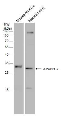 APOBEC2 antibody detects APOBEC2 protein by western blot analysis.Various mouse tissue extracts (50 μg) were separated by 12 % SDS-PAGE, and the membrane was blotted with APOBEC2 antibody (GTX130521) at a dilution of 1:1000.