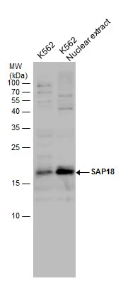 SAP18 antibody detects SAP18 protein by western blot analysis. K562 whole cell extracts and nuclear extracts (30 μg) were separated by 15% SDS-PAGE, and the membrane was blotted with SAP18 antibody (GTX130522) at a dilution of 1:1000 and developed with Trident femto Western HRP Substrate (GTX14698).