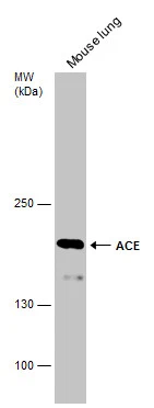 Mouse tissue extract (50 μg) was separated by 5% SDS-PAGE, and the membrane was blotted with ACE antibody (GTX130534) diluted at 1:2000.