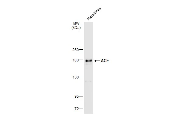 Rat tissue extract (50 μg) was separated by 5% SDS-PAGE, and the membrane was blotted with ACE antibody (GTX130534) diluted at 1:500. The HRP-conjugated anti-rabbit IgG antibody (GTX213110-01) was used to detect the primary antibody.