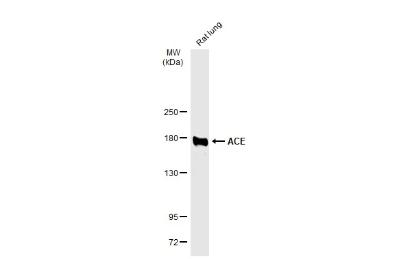 Rat tissue extract (50 μg) was separated by 5% SDS-PAGE, and the membrane was blotted with ACE antibody (GTX130534) diluted at 1:500. The HRP-conjugated anti-rabbit IgG antibody (GTX213110-01) was used to detect the primary antibody.