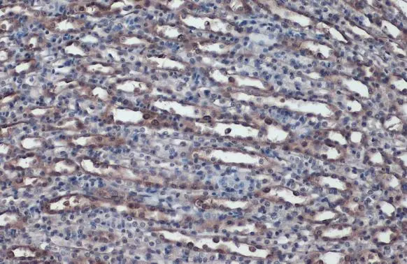 ACE antibody detects ACE protein at cell membrane and cytoplasm by immunohistochemical analysis. Sample: Paraffin-embedded mouse kidney. ACE stained by ACE antibody (GTX130534) diluted at 1:1000. Antigen Retrieval: Citrate buffer, pH 6.0, 15 min