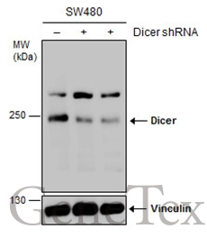 Non-transfected (–) and transfected (+) SW480 whole cell extracts (30 μg) were separated by 5% SDS-PAGE, and the membrane was blotted with Dicer antibody (GTX130536) diluted at 1:1000. The HRP-conjugated anti-rabbit IgG antibody (GTX213110-01) was used to detect the primary antibody.