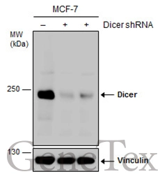 Non-transfected (–) and transfected (+) MCF-7 whole cell extracts (30 μg) were separated by 5% SDS-PAGE, and the membrane was blotted with Dicer antibody (GTX130536) diluted at 1:1000. The HRP-conjugated anti-rabbit IgG antibody (GTX213110-01) was used to detect the primary antibody.