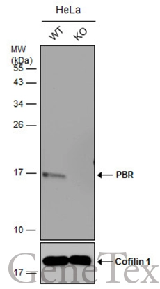 Wild-type (WT) and PBR knockout (KO) HeLa cell extracts (30 μg) were separated by 15% SDS-PAGE, and the membrane was blotted with PBR antibody (GTX130550) diluted at 1:5000. The HRP-conjugated anti-rabbit IgG antibody (GTX213110-01) was used to detect the primary antibody. Wild-type (WT) and PBR knockout (KO) HeLa cell extracts (30 μg) were separated by 15% SDS-PAGE, and the membrane was blotted with PBR antibody (GTX130550) diluted at 1:5000. The HRP-conjugated anti-rabbit IgG antibody (GTX213110-01) was used to detect the primary antibody.