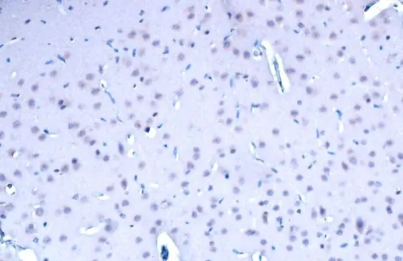 BRD4 antibody detects BRD4 protein at nucleus by immunohistochemical analysis. Sample: Paraffin-embedded rat brain. BRD4 stained by BRD4 antibody (GTX130586) diluted at 1:500. Antigen Retrieval: Citrate buffer, pH 6.0, 15 min