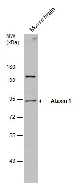 Mouse tissue extract (50 μg) was separated by 7.5% SDS-PAGE, and the membrane was blotted with Ataxin 1 antibody (GTX130595) diluted at 1:500.